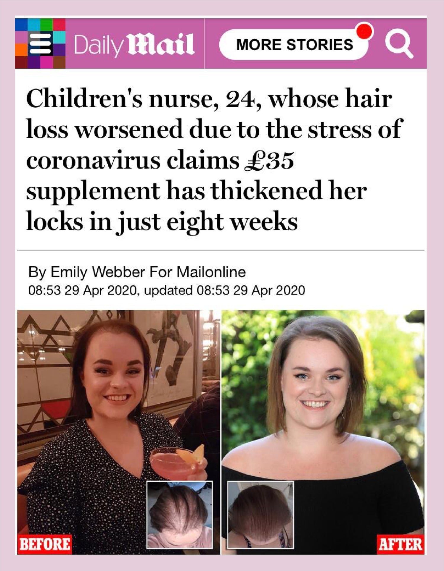 Hair Gain journey