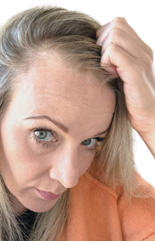 Lucy Palmer before Hair Gain image