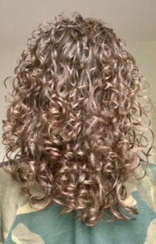 Sotira Georgiou after Hair Gain image