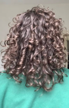 Sotira Georgiou before Hair Gain image