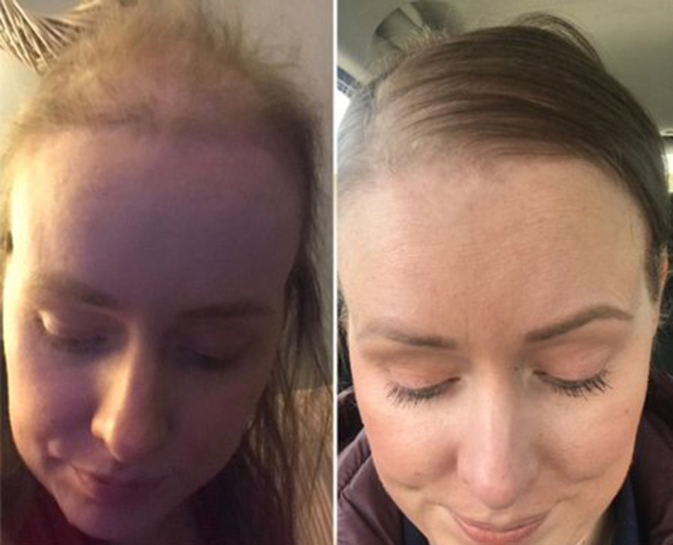 hair transformation