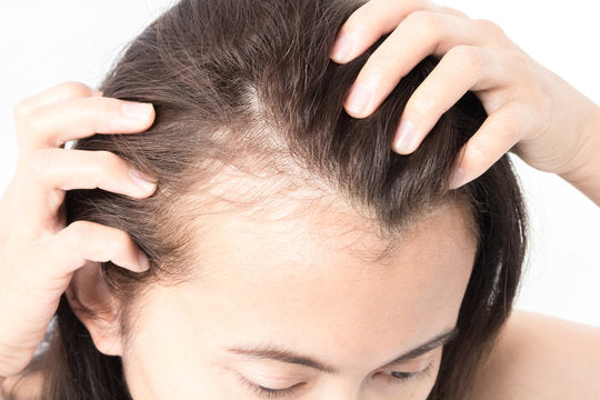 World Menopause Day Hair Gain Survey