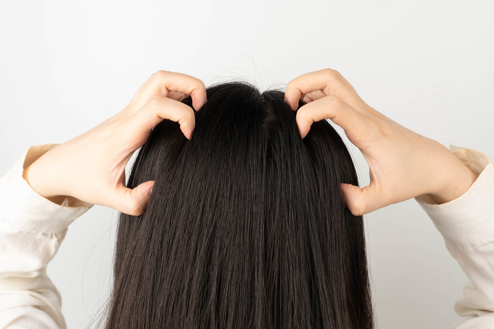 itchy scalp due to product build up