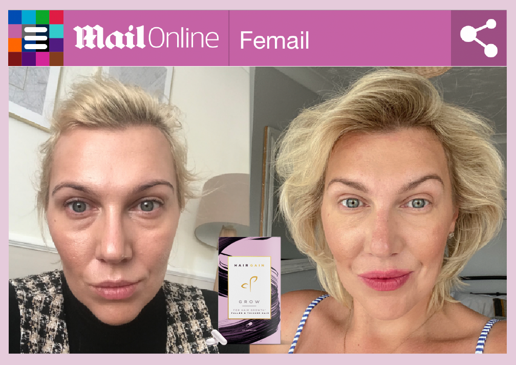 Hair Loss After Weight Loss Surgery