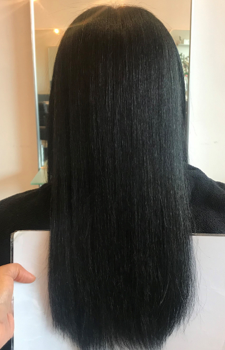 Debs Konu after Hair Gain image