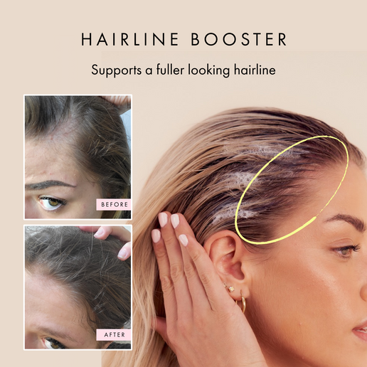 Hair Gain Scalp Foam
