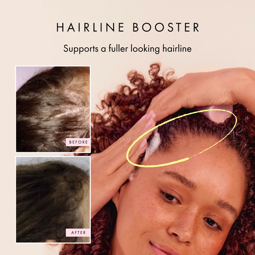 Hair Gain Scalp Foam
